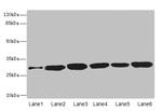 Bisphosphoglycerate mutase Antibody in Western Blot (WB)
