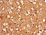 BRCC3 Antibody in Immunohistochemistry (Paraffin) (IHC (P))