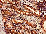 BRCC3 Antibody in Immunohistochemistry (Paraffin) (IHC (P))