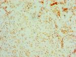 BRCC3 Antibody in Immunohistochemistry (Paraffin) (IHC (P))