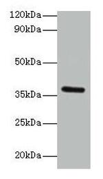 BRCC3 Antibody in Western Blot (WB)