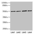 C21orf63 Antibody in Western Blot (WB)