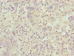 C8B Antibody in Immunohistochemistry (Paraffin) (IHC (P))