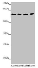 C8B Antibody in Western Blot (WB)