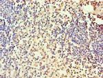 Carbonic Anhydrase I Polyclonal Antibody