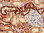Carbonic Anhydrase XII Antibody in Immunohistochemistry (Paraffin) (IHC (P))