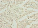 CAP2 Antibody in Immunohistochemistry (Paraffin) (IHC (P))
