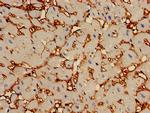 CAP2 Antibody in Immunohistochemistry (Paraffin) (IHC (P))