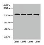 CAP2 Antibody in Western Blot (WB)