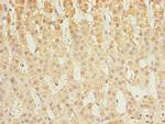 Calpain S1 Polyclonal Antibody