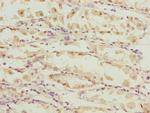 Calpain S1 Antibody in Immunohistochemistry (Paraffin) (IHC (P))