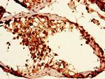 CAPZA1 Antibody in Immunohistochemistry (Paraffin) (IHC (P))