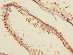 MTGR1 Polyclonal Antibody