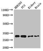 CBR1 Antibody in Western Blot (WB)