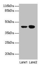 CCR6 Polyclonal Antibody