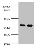 CD1a Antibody in Western Blot (WB)