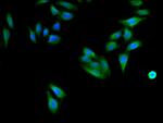 CD96 Polyclonal Antibody