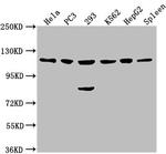 CDKL5 Antibody in Western Blot (WB)