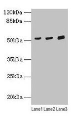 CDR2 Antibody in Western Blot (WB)