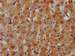 CDS2 Polyclonal Antibody