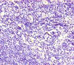 CDSN Antibody in Immunohistochemistry (Paraffin) (IHC (P))