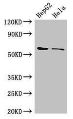 CDT1 Polyclonal Antibody