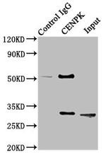 CENPK Antibody in Western Blot (WB)