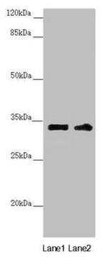 CENPK Antibody in Western Blot (WB)