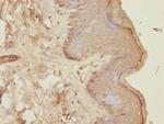 CENPK Antibody in Immunohistochemistry (Paraffin) (IHC (P))