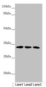 CENPK Antibody in Western Blot (WB)