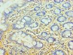 Complement Factor H Polyclonal Antibody