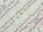 CHN1 Antibody in Immunohistochemistry (Paraffin) (IHC (P))