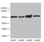 CHN1 Antibody in Western Blot (WB)
