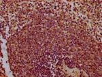 Chondrolectin Antibody in Immunohistochemistry (Paraffin) (IHC (P))