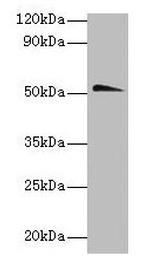 CHRNA1 Polyclonal Antibody