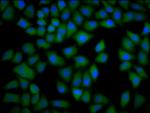CKAP4 Antibody in Immunocytochemistry (ICC/IF)