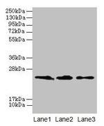 Claudin 20 Antibody in Western Blot (WB)