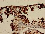 CLGN Antibody in Immunohistochemistry (Paraffin) (IHC (P))