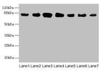 CLGN Antibody in Western Blot (WB)