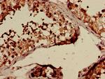 CLTCL1 Antibody in Immunohistochemistry (Paraffin) (IHC (P))