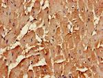 CLTCL1 Antibody in Immunohistochemistry (Paraffin) (IHC (P))