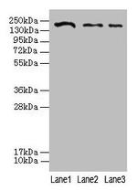 CLTCL1 Antibody in Western Blot (WB)