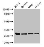 Mast Cell Chymase Polyclonal Antibody