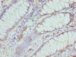 CMPK1 Polyclonal Antibody