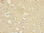 COPZ1 Antibody in Immunohistochemistry (Paraffin) (IHC (P))