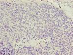 COPZ1 Antibody in Immunohistochemistry (Paraffin) (IHC (P))