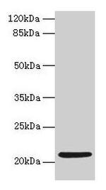 COPZ1 Antibody in Western Blot (WB)
