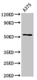Carboxypeptidase E Polyclonal Antibody