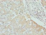 CPN1 Antibody in Immunohistochemistry (Paraffin) (IHC (P))
