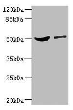 CPN1 Antibody in Western Blot (WB)